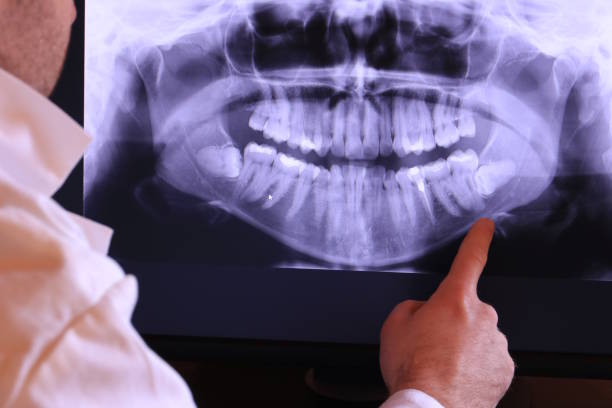 Best Emergency Tooth Extraction  in Burton, OH