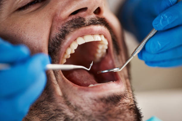 Urgent Tooth Repair in OH
