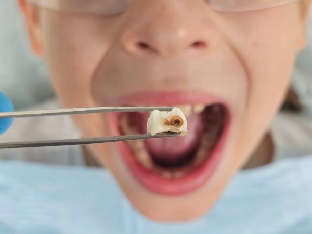 Best Affordable Emergency Dental Care  in Burton, OH